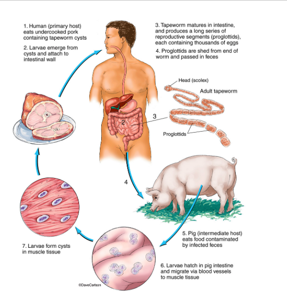 Signs And Symptoms Of Tapeworm Infections In Humans Sunshine Todaytt